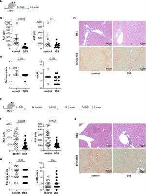 A protective effect of inflammatory bowel disease on the severity of sclerosing cholangitis